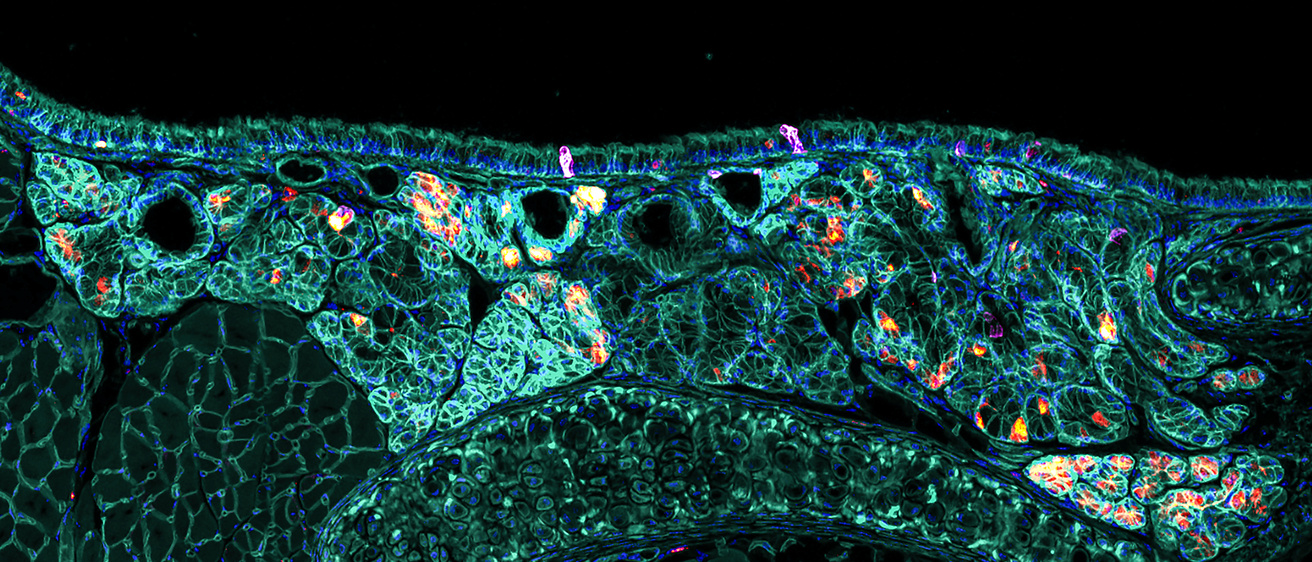 Glands