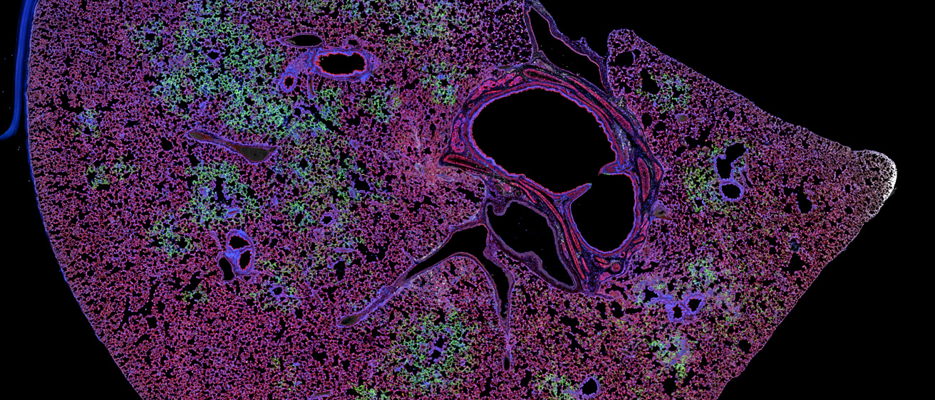 confocal snapshot2
