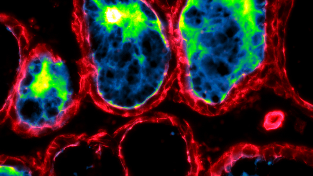 Thyroid-Staining-Lectin